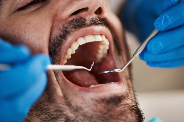 Best Cosmetic Emergency Dentistry in Bull Mountain, OR